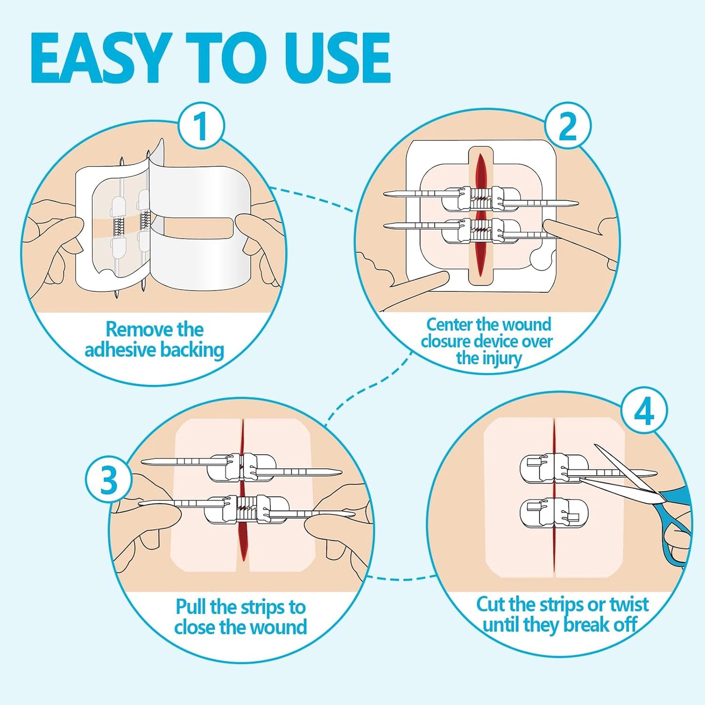 Suture Wound Closure Strips – Zip Stitch & Butterfly Bandage Kit