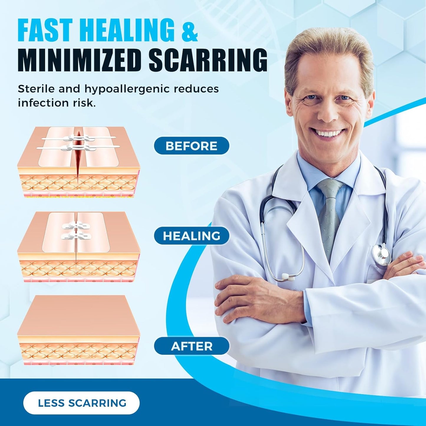 Suture Wound Closure Strips – Zip Stitch & Butterfly Bandage Kit